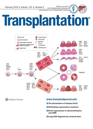 Transplantation® Online